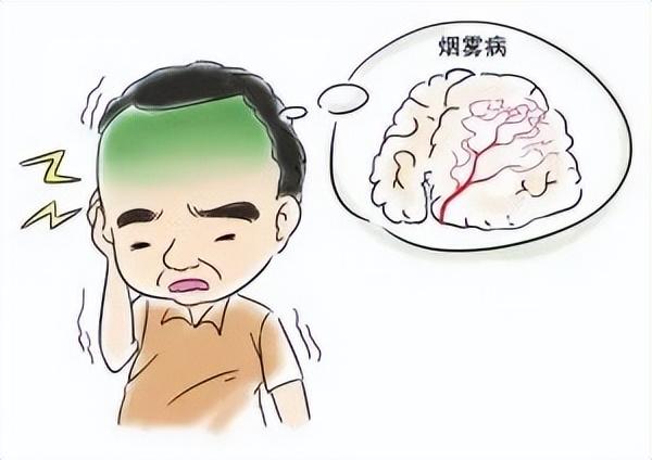穿越火線最新煙霧頭調(diào)法攻略